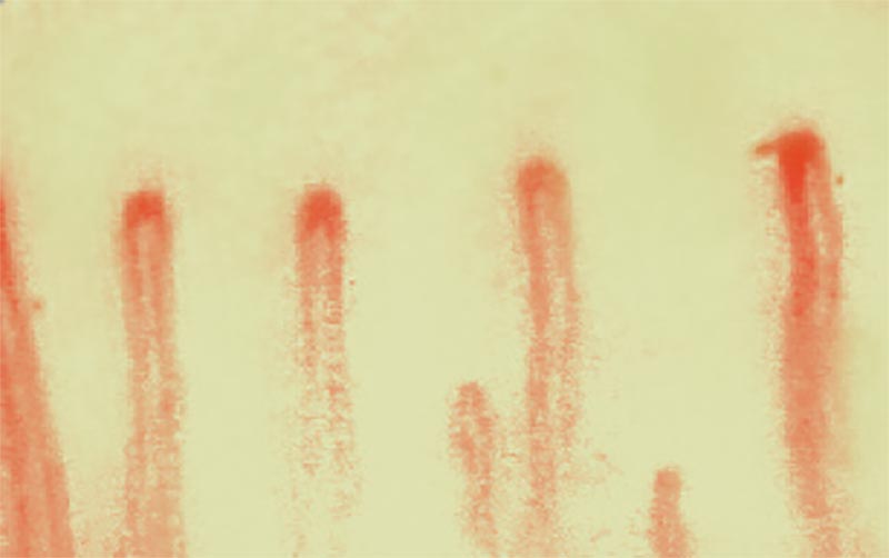 Health capillaries
